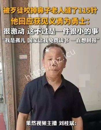 救女子被咬掉鼻子